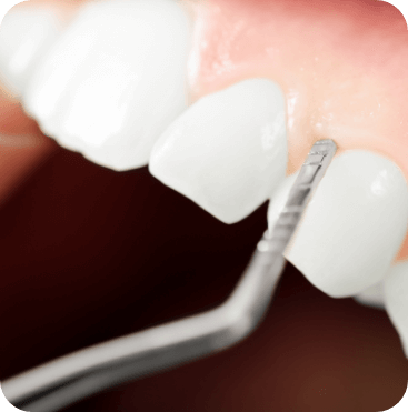 photo of dental tool touching gums